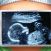 Step-by-Step Tutorial: Master Operate Now Hospital  for Better Games